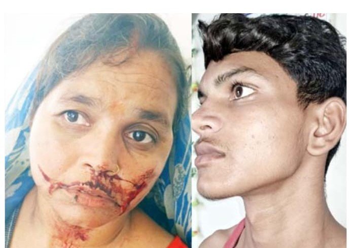 इस्लामनगर में कोटेदार की दबंगई: मां बेटा को पीटकर किया लहूलुहान