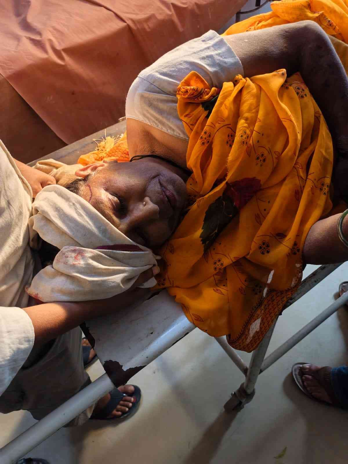  के पहिए में साड़ी फंसने से महिला गंभीर 