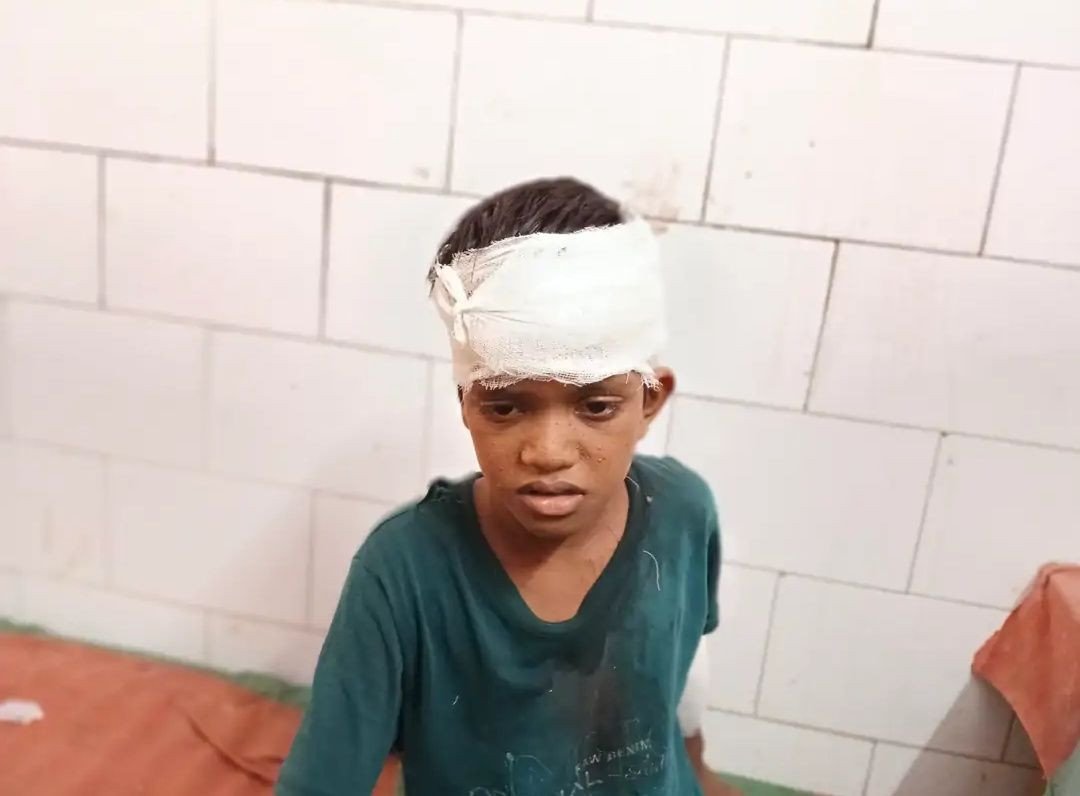 कुत्ते ने 13 वर्षीय छात्र पर किया हमला,चेहरे और हाथों में काटा