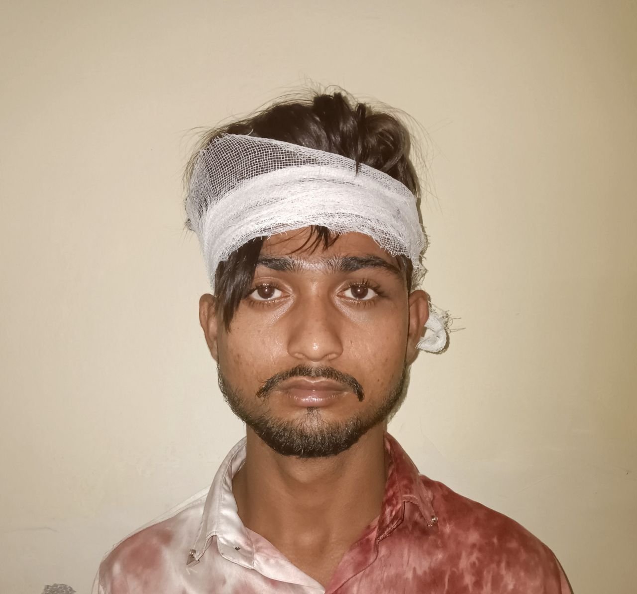 मेले से लौट रहे युवक को घेरकर पीटा, सिर से बहा खून; मां से भी मारपीट